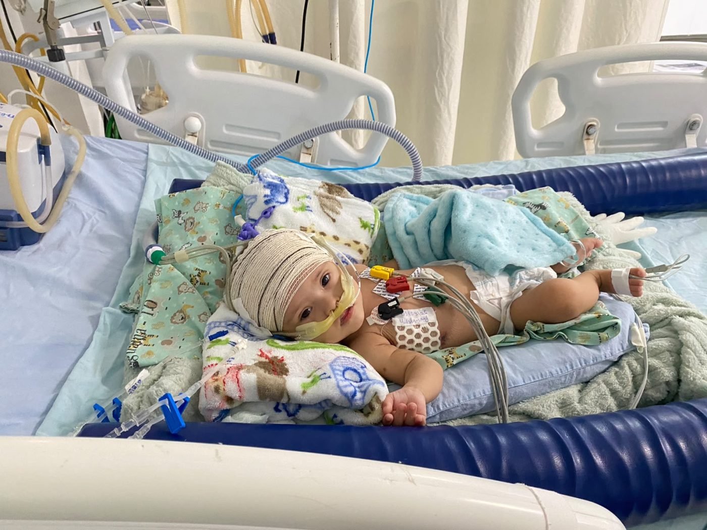Lucas, que tem síndrome de Down, foi internado no Hospital HMA para correção de comunicação interatrial (CIA) e comunicação interventricular (CIV) — Foto: Divulgação